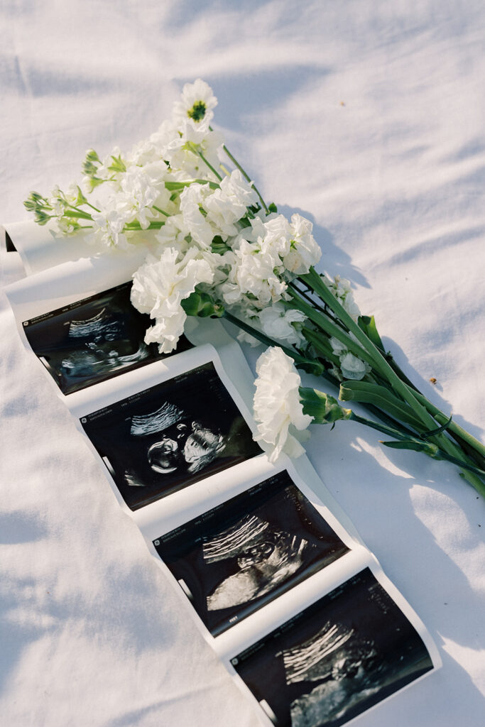 Maternity Session, ultrasound photos on a picnic blanket